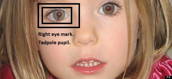 [madeleine mccann right eye mark huffingtonpost, picture source: http://www.huffingtonpost.co.uk/2013/05/29/madeleine-mccann-news-weird-stranger-seen-lurking-_n_3350983.html]